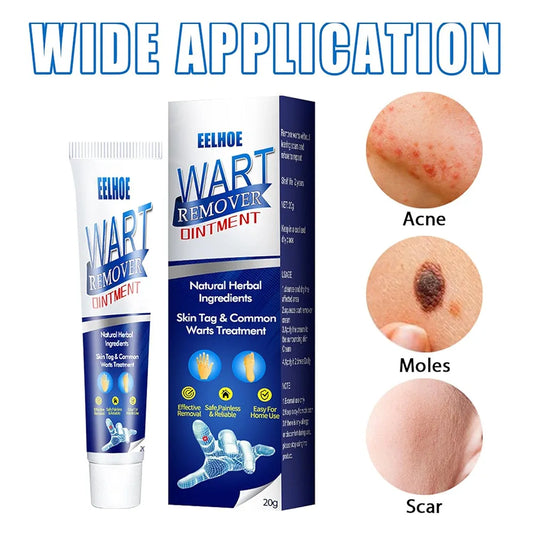 🌿 WartAway™ Herbal Removal Cream